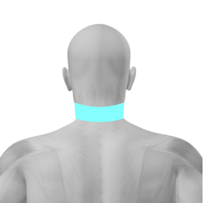 Laser Hair Removal for men's neck back behind